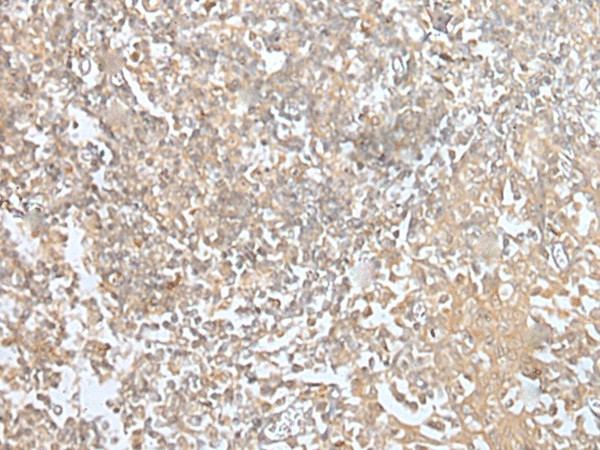 Immunohistochemistry of paraffin-embedded Human tonsil tissue  using MORF4L1 Polyclonal Antibody at dilution of 1:45(?200)