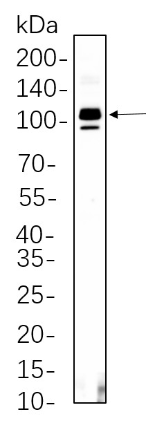 Recombinant SATB2 Monoclonal Antibody-searchlist-1