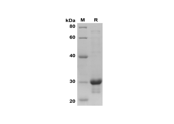 Recombinant Mouse GM-CSF Protein(His Tag)-产品推荐-1