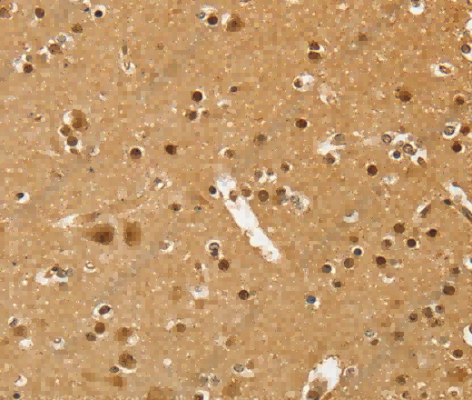PSMC1 Polyclonal Antibody - 3