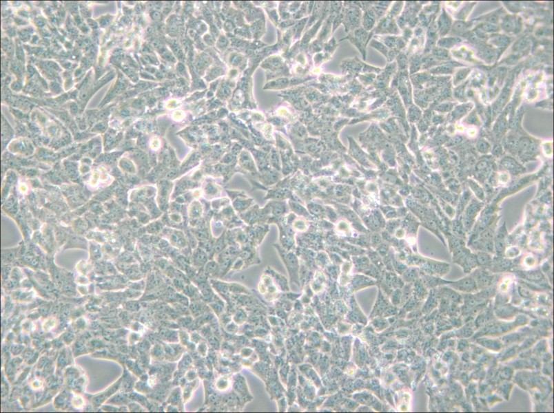 NCI-H295R Cell Complete Medium - 4