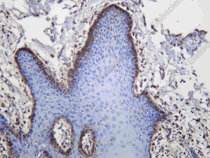 Recombinant FGF21 Monoclonal Antibody - 2