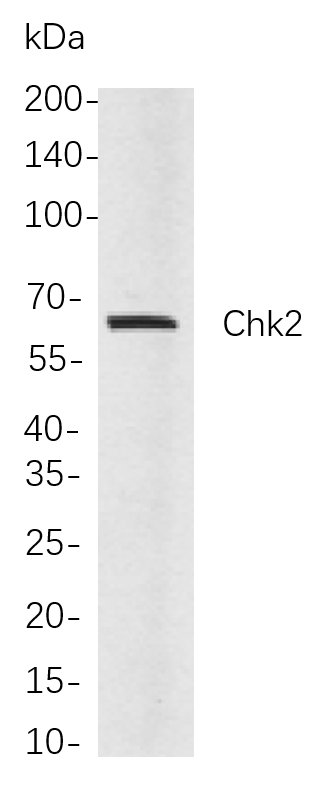 Recombinant Chk2 Monoclonal Antibody-searchlist-1