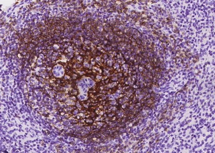 CD21 Monoclonal Antibody - small - 3