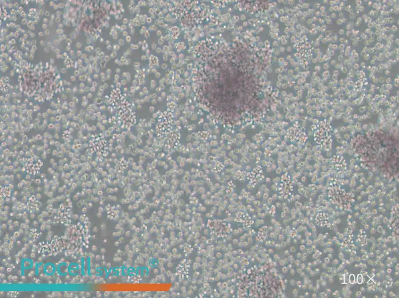 Granta-519 Cell Complete MediumGranta-519 Cell Complete Medium - 2