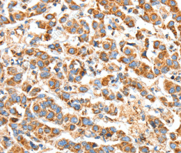 BAK1 Polyclonal Antibody - 3