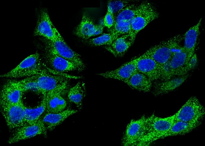 Recombinant SULT1A1 Monoclonal Antibody - small - 1