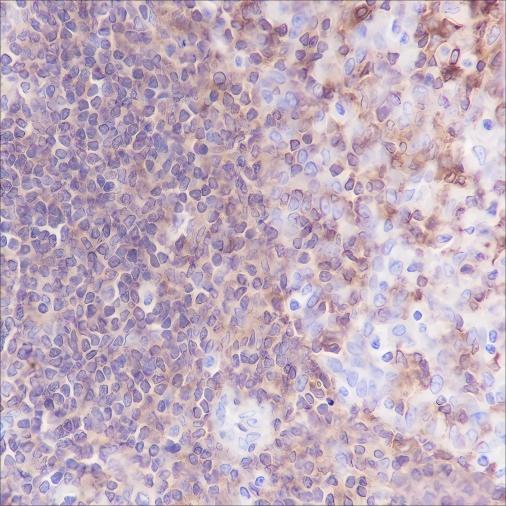 Recombinant CSF-1R Monoclonal Antibody - small - 2