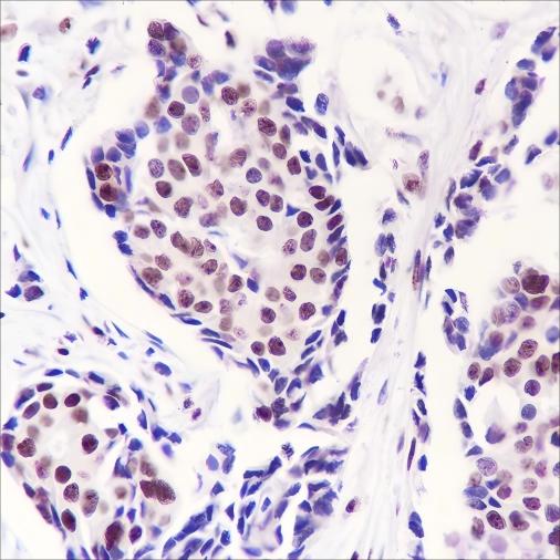 Recombinant PELP1 Monoclonal Antibody - small - 2