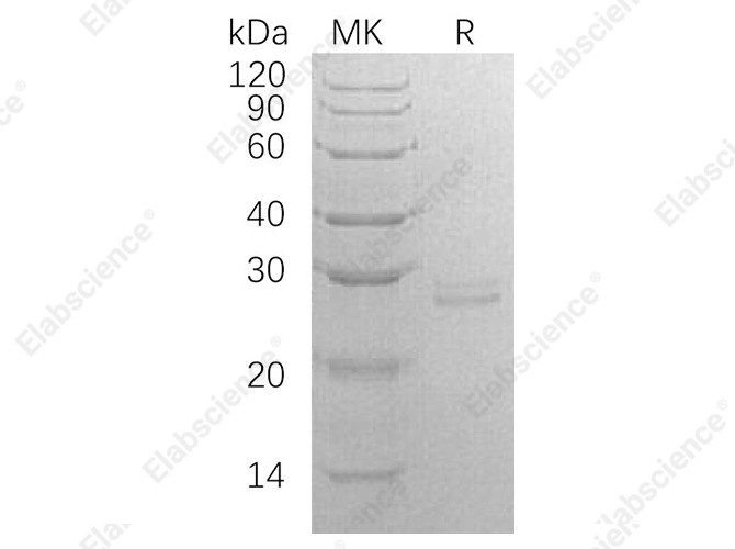 Recombinant Human RPE Protein (E.coli, His Tag) - 1