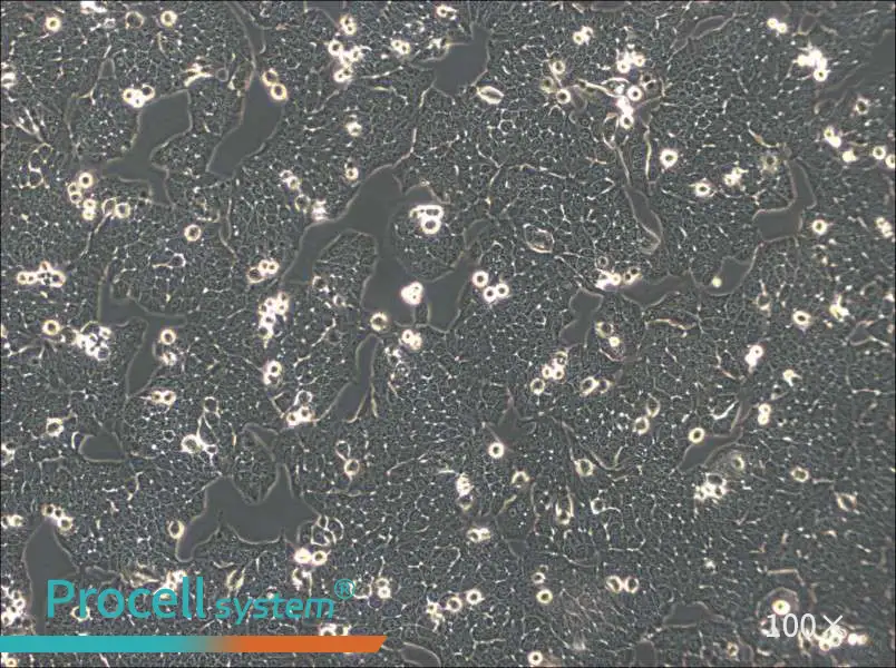 WSU-HN30 Cell Complete Medium - 2