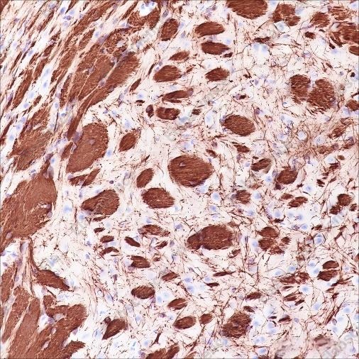 Recombinant MAG Monoclonal Antibody - 6