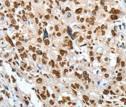 BNIP1 Polyclonal Antibody - 2