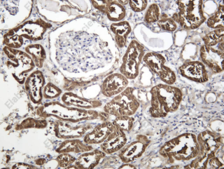 Recombinant Midkine Monoclonal Antibody - 1