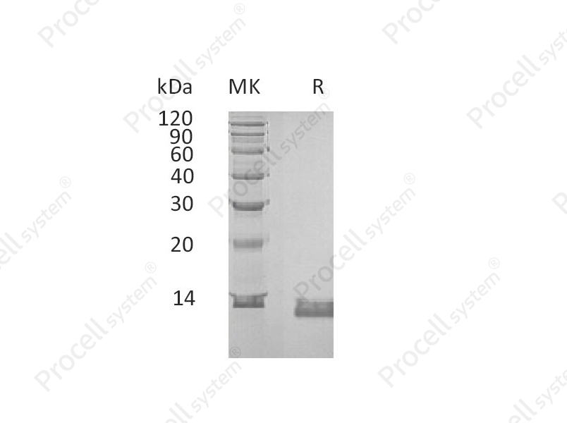 IL-8/CXCL8 (C-6His), Human, Recombinant