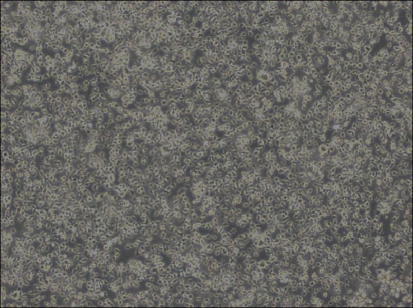 MEC-1 Cell Complete Medium - 2