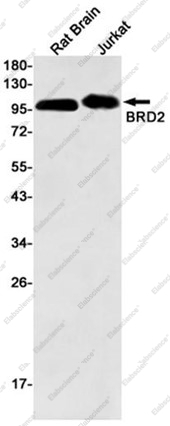 Recombinant BRD2 Monoclonal Antibody - 1