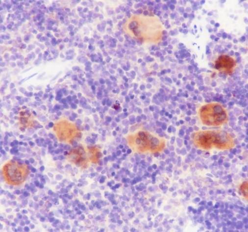 Recombinant TGF beta 1 Monoclonal Antibody - small - 4