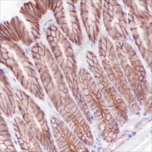 Recombinant PI3 Kinase p110 alpha Monoclonal Antibody - 5
