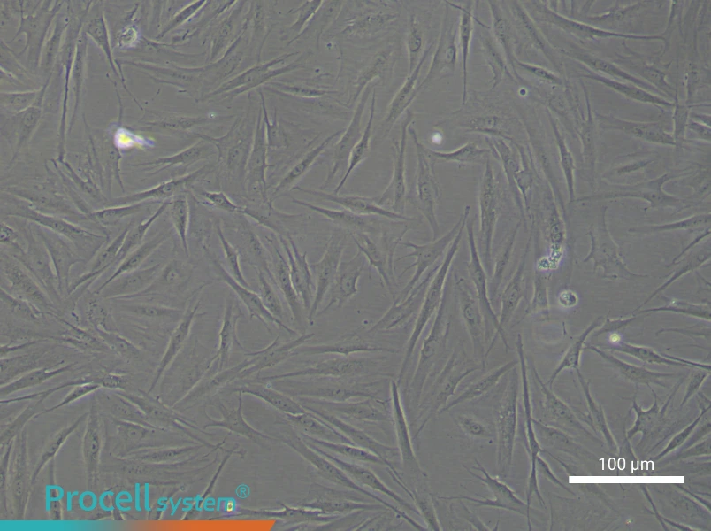 Human Aortic Adventitial Fibroblast Complete Medium - 1