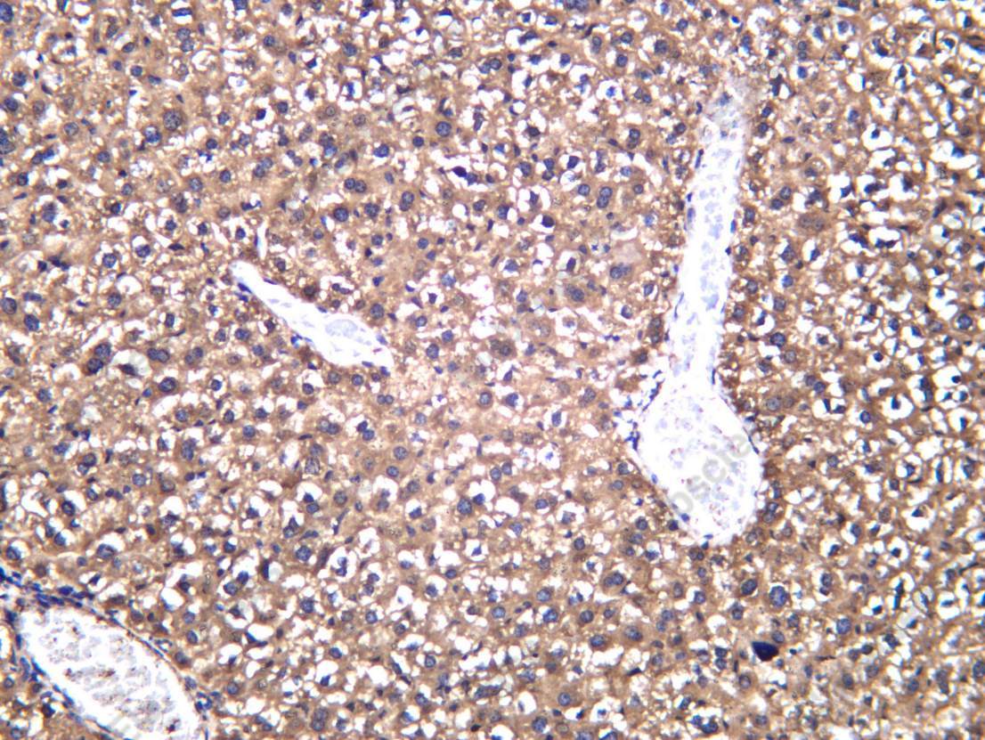 Recombinant L-Lactyl Lysine Monoclonal Antibody - 5