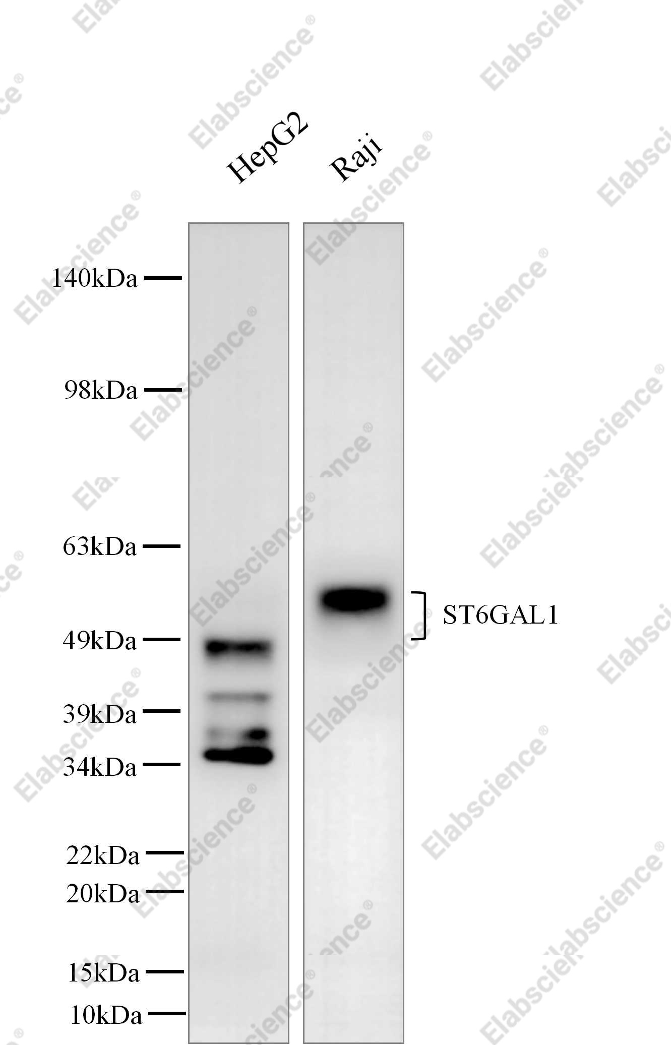 Recombinant ST6GAL1/ST6GAL-I Monoclonal Antibody - 1