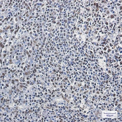 Recombinant hnRNP Q Monoclonal Antibody - 5