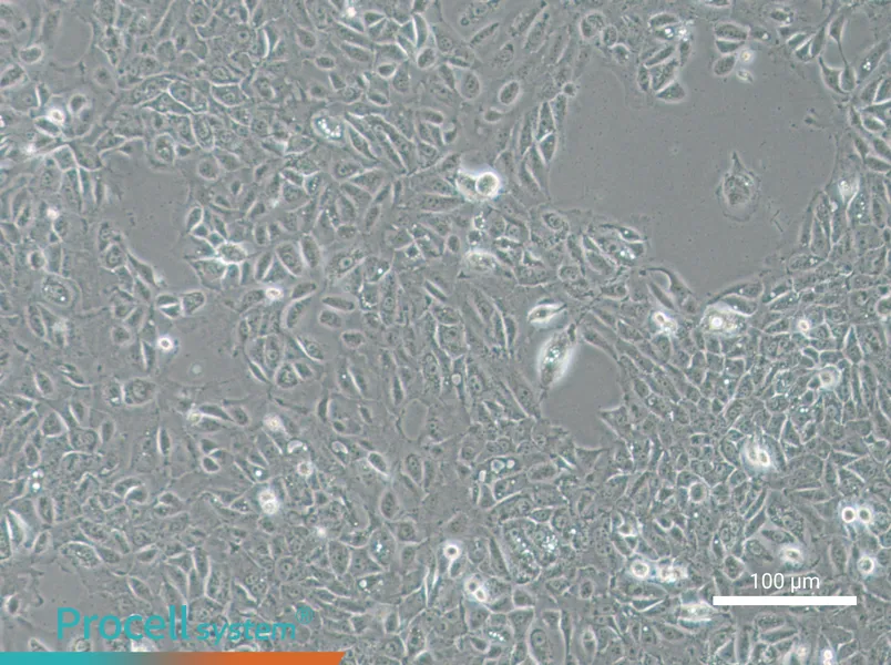 NCI-H1666NCI-H1666 - 3