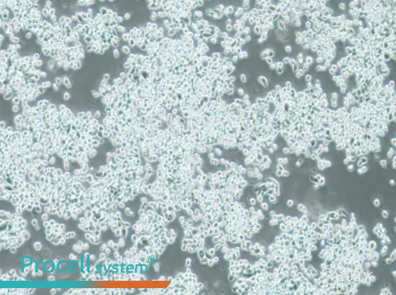 KMS-11 Cell Complete Medium - 2