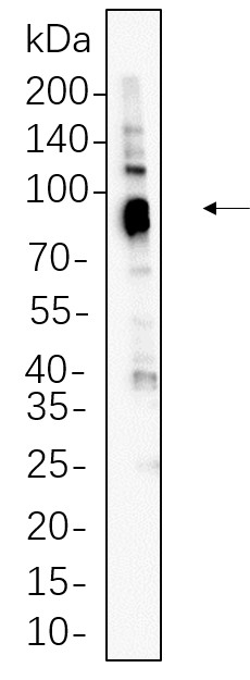 Recombinant MDM2 Monoclonal Antibody-searchlist-1
