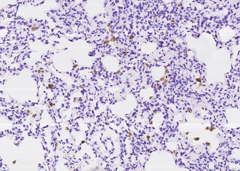 Recombinant CD68 Monoclonal Antibody