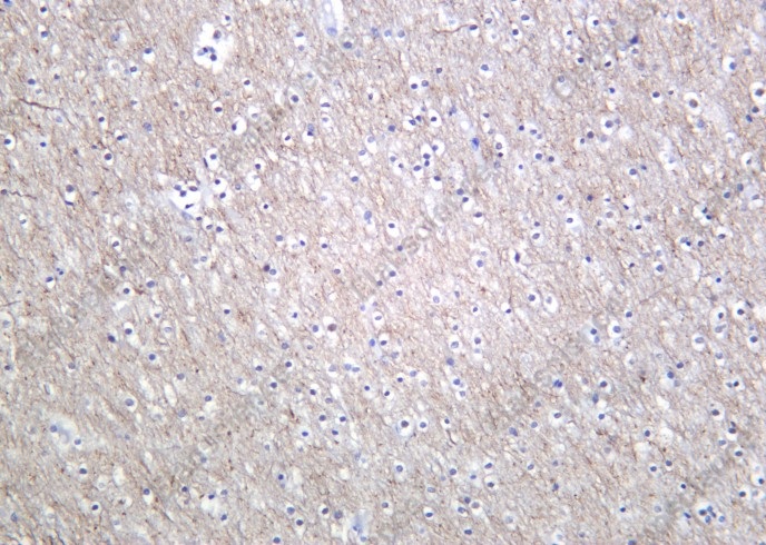 Recombinant Phospho-Tau (Ser396) Monoclonal Antibody - 2