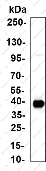 Recombinant DOR-1 Monoclonal Antibody - 1