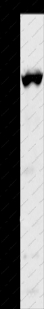 TRPM5 Polyclonal Antibody - 1