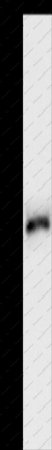 HCK Polyclonal Antibody - 1