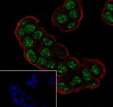 Recombinant Topoisomerase I Monoclonal Antibody - small - 4