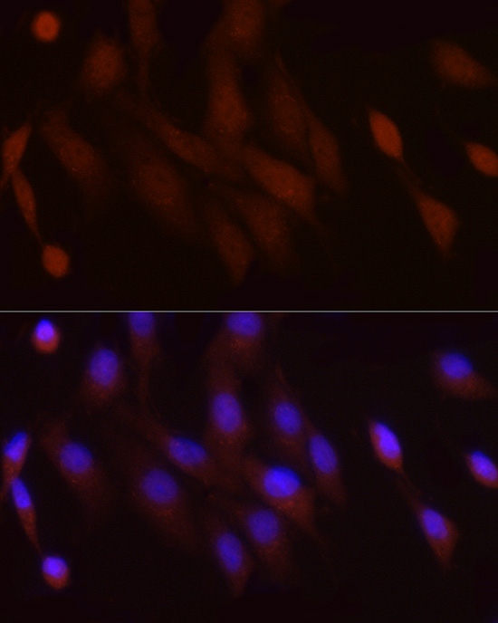 PGC1 alpha Polyclonal Antibody - small - 6