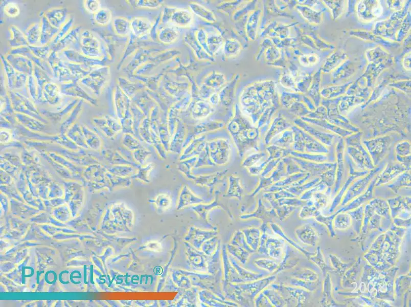 VCaP Cell Complete Medium - small - 5