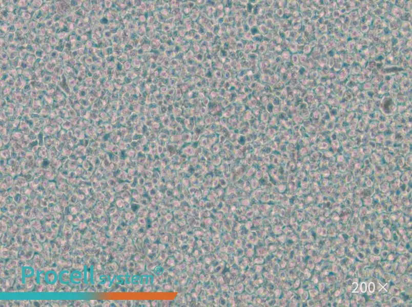 OPM2 Cell Complete Medium - 6