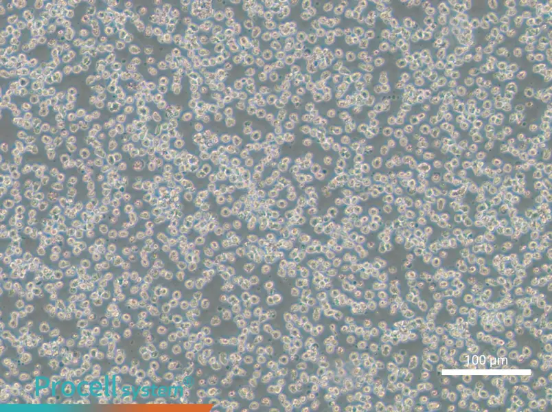 OPM2OPM2 - 2