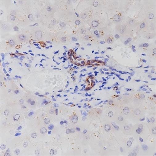 Recombinant Nestin Monoclonal Antibody - 3