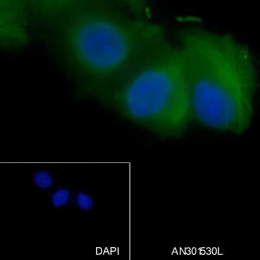 Recombinant GLP-1 Monoclonal Antibody - small - 5