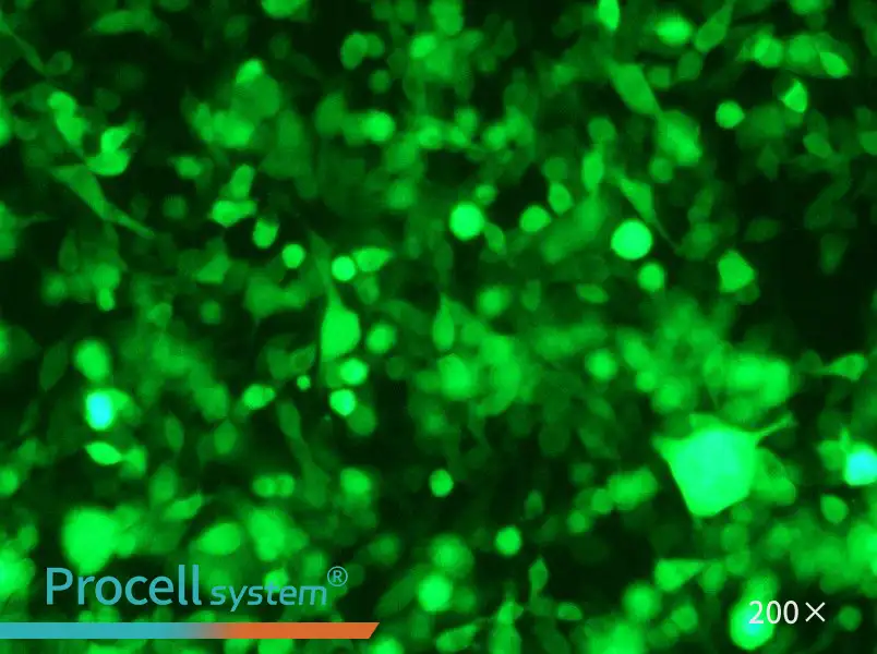 RM-1-GFP Cell Complete Medium - 6