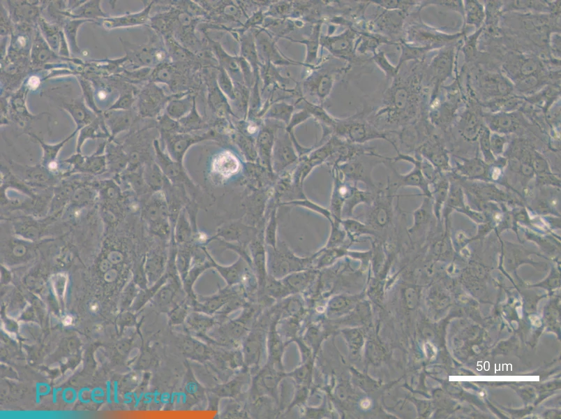 Tb 1 Lu Cell Complete Medium - 5