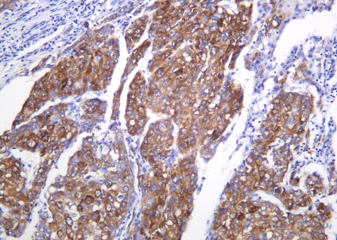 Recombinant Shh Monoclonal Antibody-searchlist-1