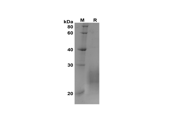 Recombinant Rat IL-5 Protein(His Tag)-1