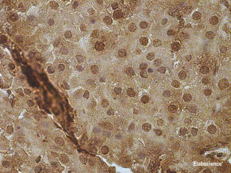 Purified Anti-Human CD10 Antibody[CB-CALLA]-产品推荐-1
