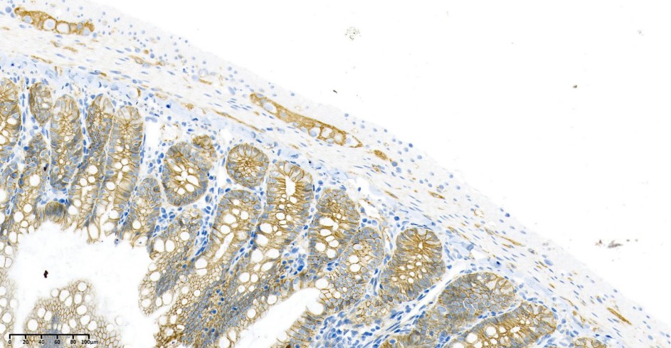 Recombinant β Catenin Monoclonal Antibody - small - 2