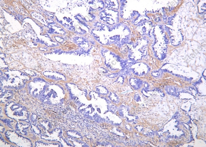 Recombinant SREBP-1 Monoclonal Antibody - 1