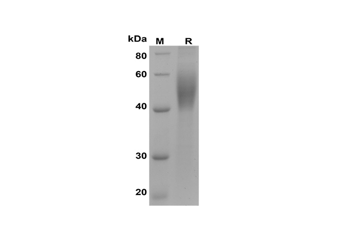 Recombinant Rat IL-6 Protein-产品推荐-4